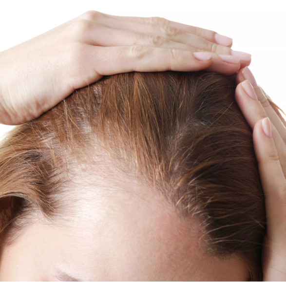 Unraveling the Top 10 Common Causes of Hair Loss